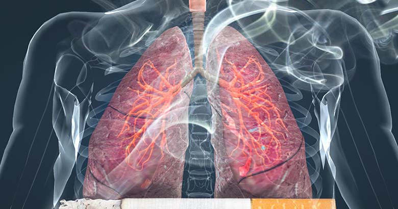 Роль курения в развитии системной вазомоторной дисфункции эндотелия у больных ХОБЛ