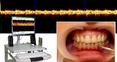 Оценка гемодинамики в тканях пародонта и пульпе зуба по данным ультразвуковой допплерографии