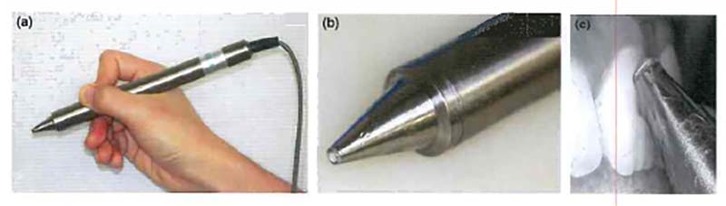 Измерение скорости кровотока пульпы в передних зубах верхней челюсти с использованием ультразвуковой допплеровской флоуметрии